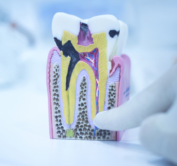 Ondontologia - Endodontia